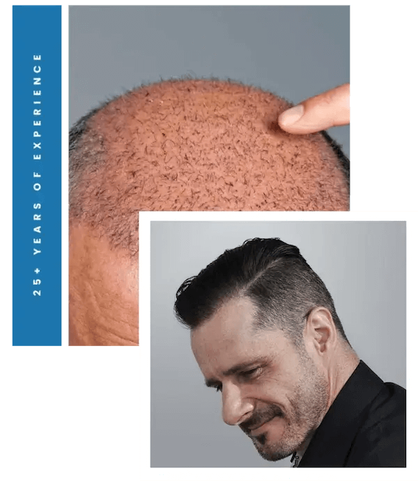 Photo of ForHair Hair Transplant Clinic